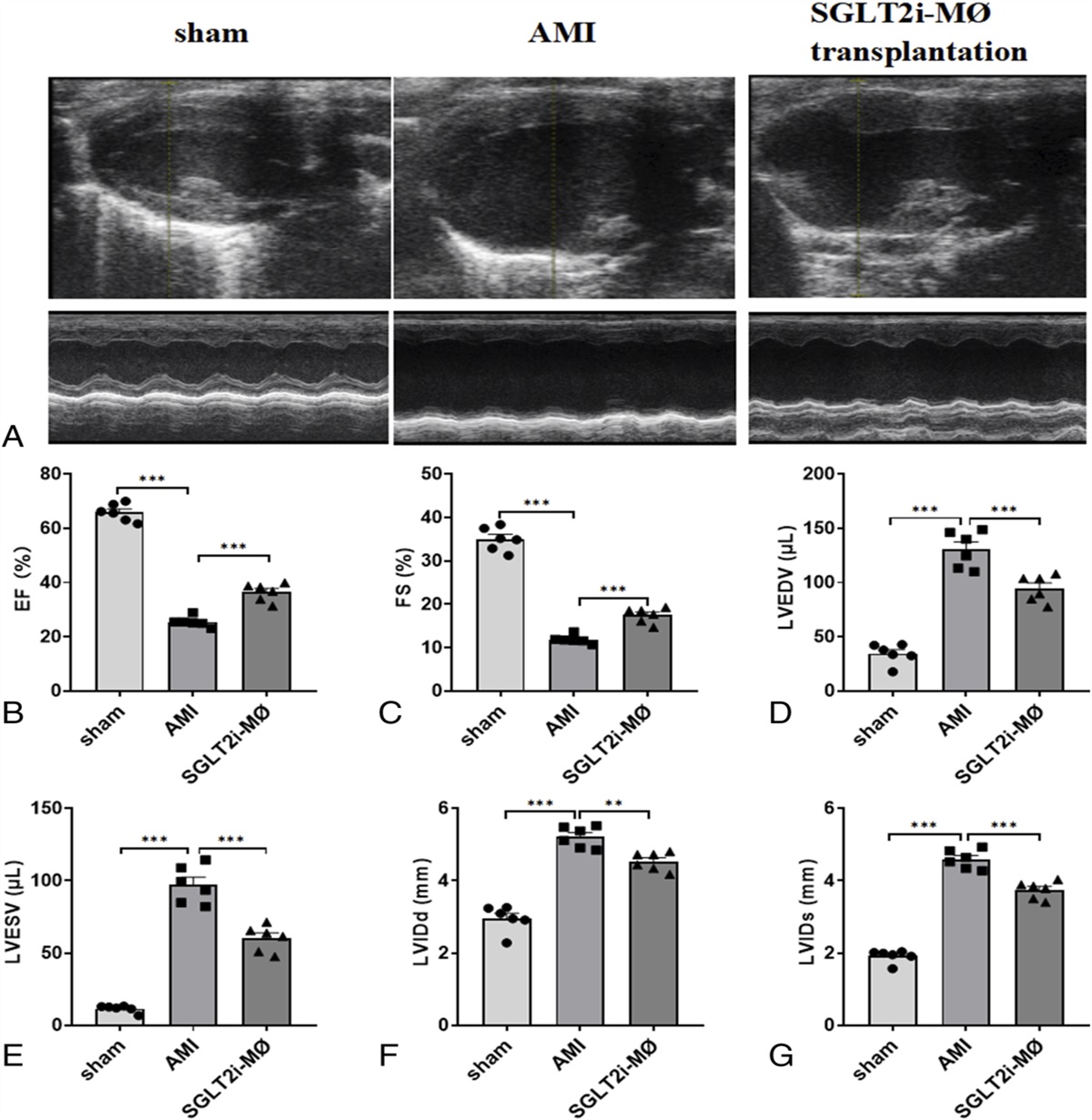 SGLT2 Inhibitor-pretreated Macrophage Transplantation Improves Adverse Ventricular Remodeling After Acute Myocardial Infarction