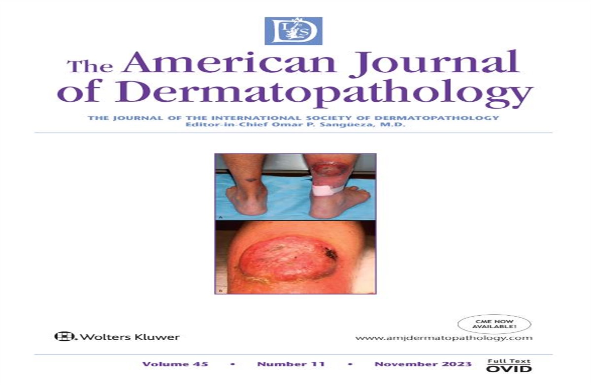 Isolated Primary Langerhans Cell Histiocytosis of the Vulva: Answer