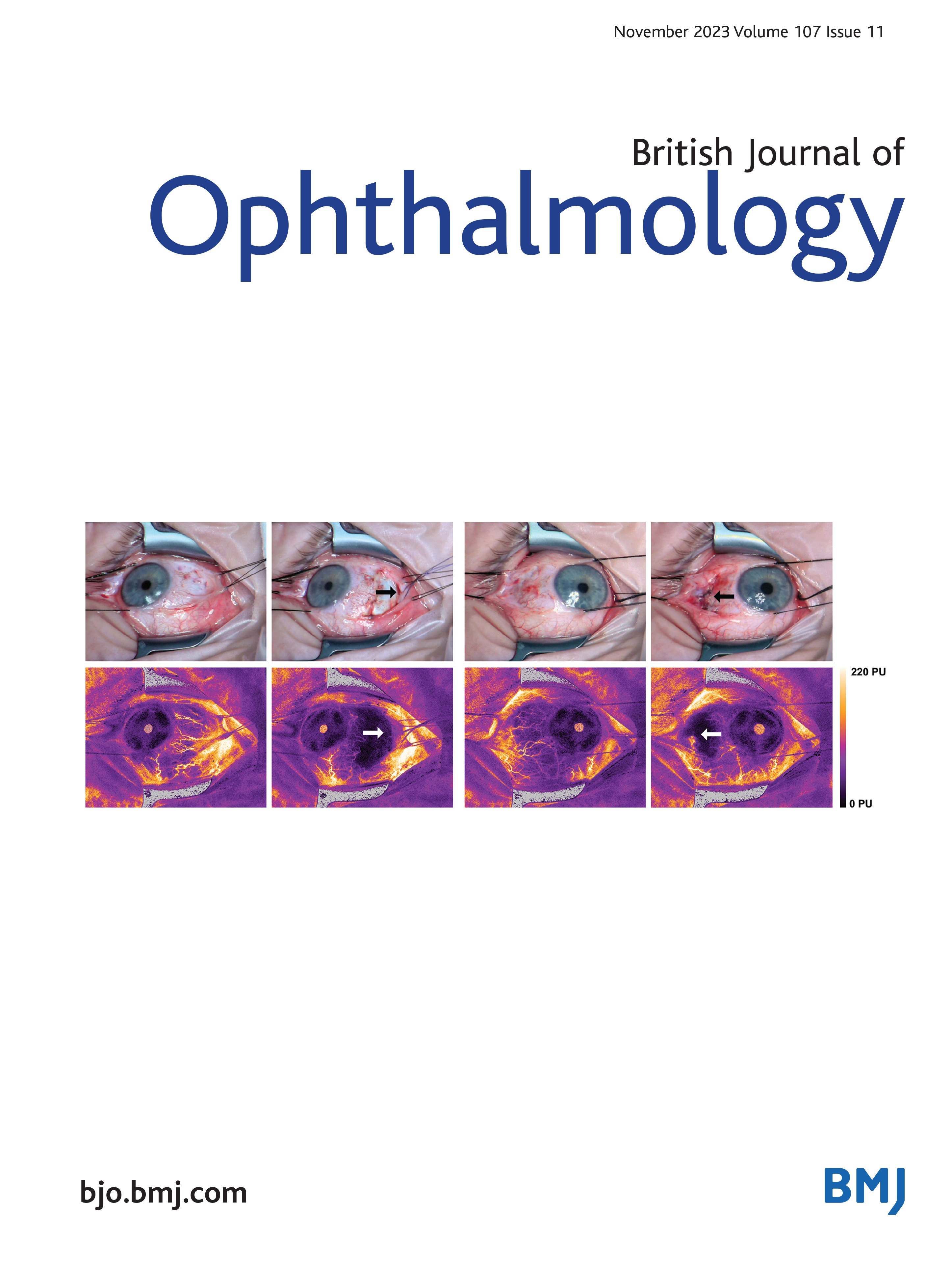 Blinking and normal ocular surface in school-aged children and the effects of age and screen time