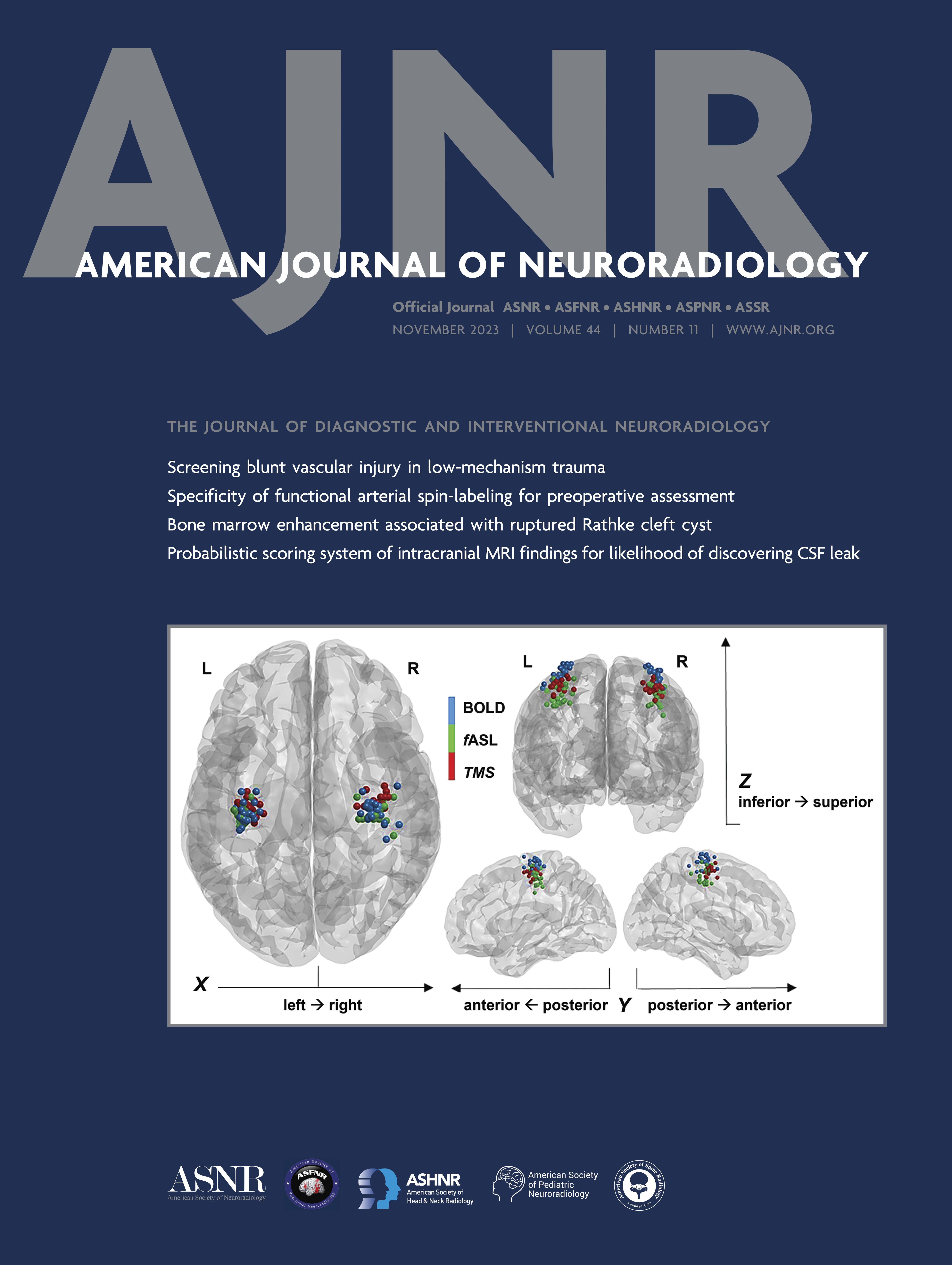 Considering Psychological and Cognitive Factors in Interventional Neuroradiology: A Systematic Literature Review [NEUROINTERVENTION]