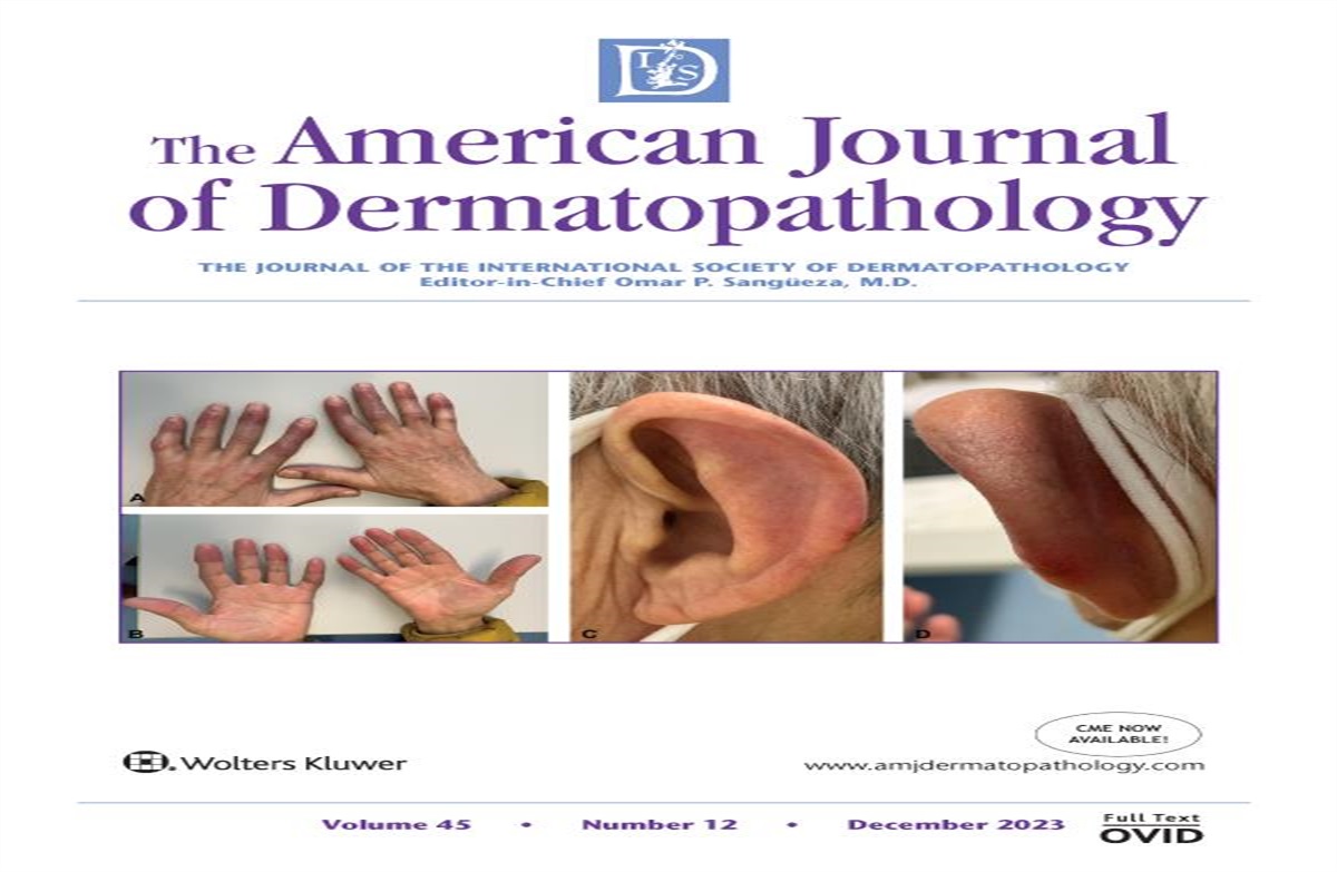 Painful Palmoplantar Lesions Following Vaccination: Answer
