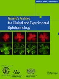 Optical characterization and through-focus performance of two advanced monofocal intraocular lenses