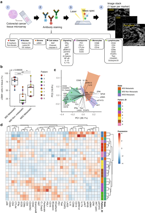 Stromal localization of inactive CD8+ T cells in metastatic mismatch repair deficient colorectal cancer